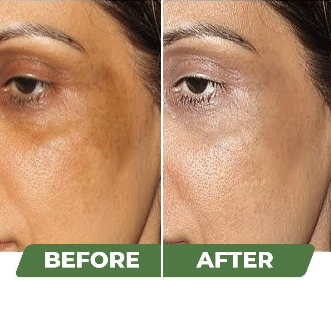 Organic Skin Brightening Cream 100 gm (Pack of 2)